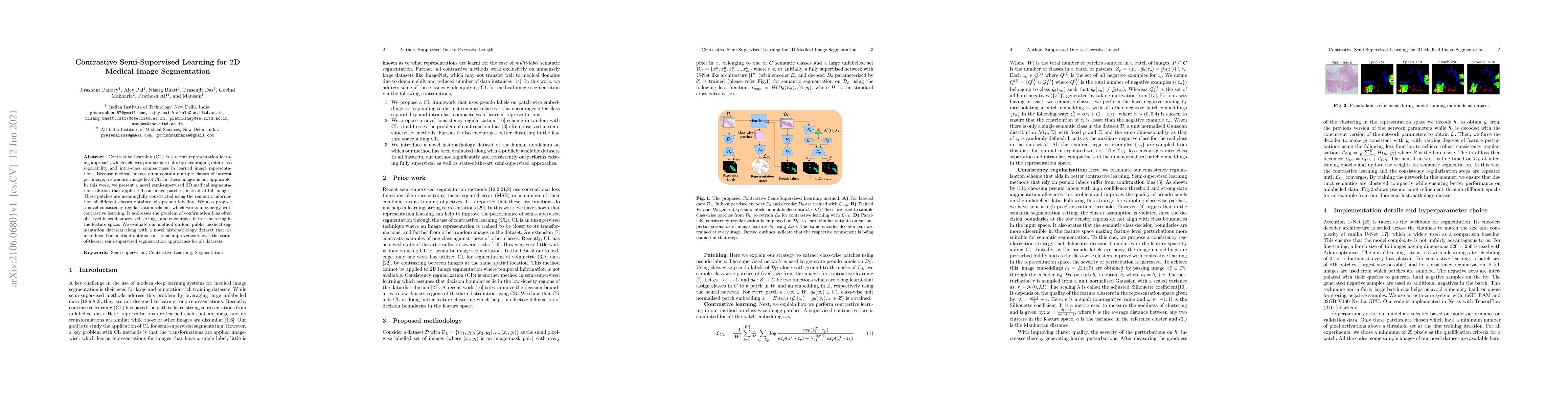 Thumbnail for Contrastive Semi-Supervised Learning for 2D Medical Image Segmentation