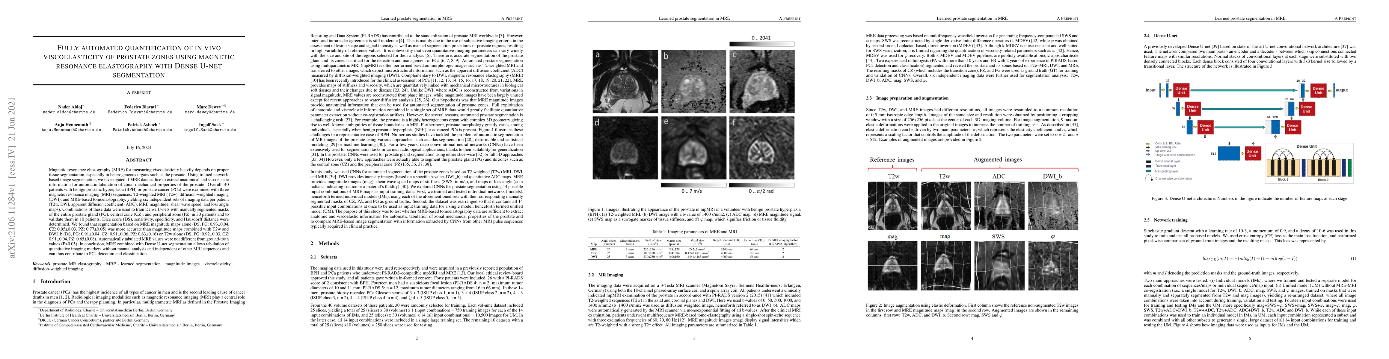 Thumbnail for Fully automated quantification of in vivo viscoelasticity of prostate
  zones using magnetic resonance elastography with Dense U-net segmentation