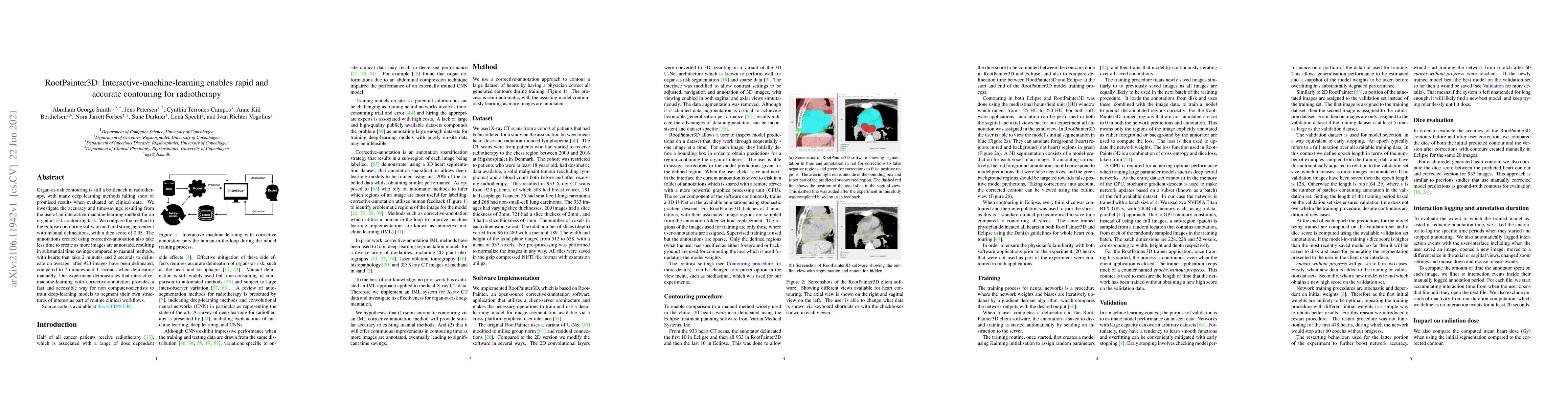 Thumbnail for RootPainter3D: Interactive-machine-learning enables rapid and accurate
  contouring for radiotherapy