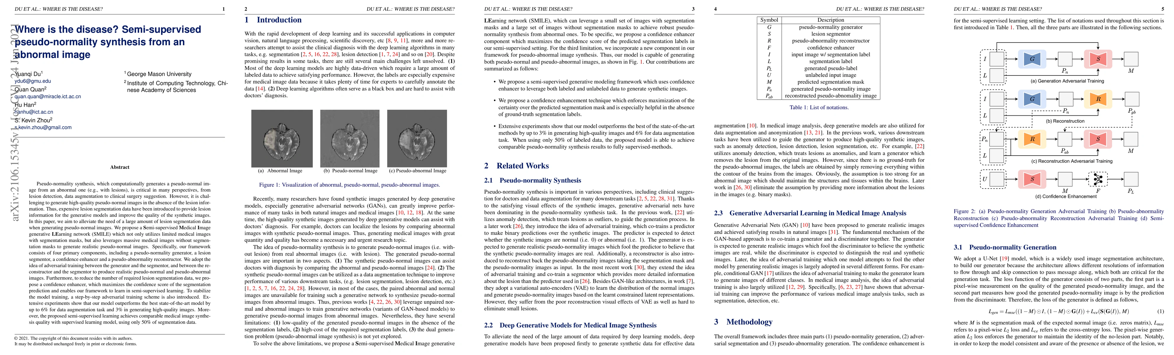 Thumbnail for Where is the disease? Semi-supervised pseudo-normality synthesis from an
  abnormal image