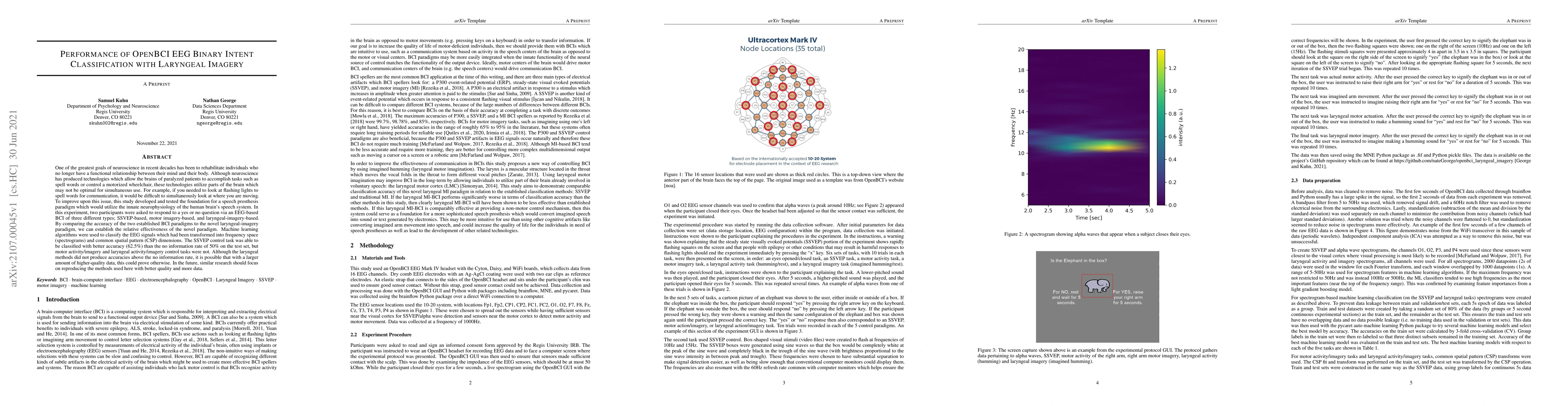 Thumbnail for Performance of OpenBCI EEG Binary Intent Classification with Laryngeal
  Imagery