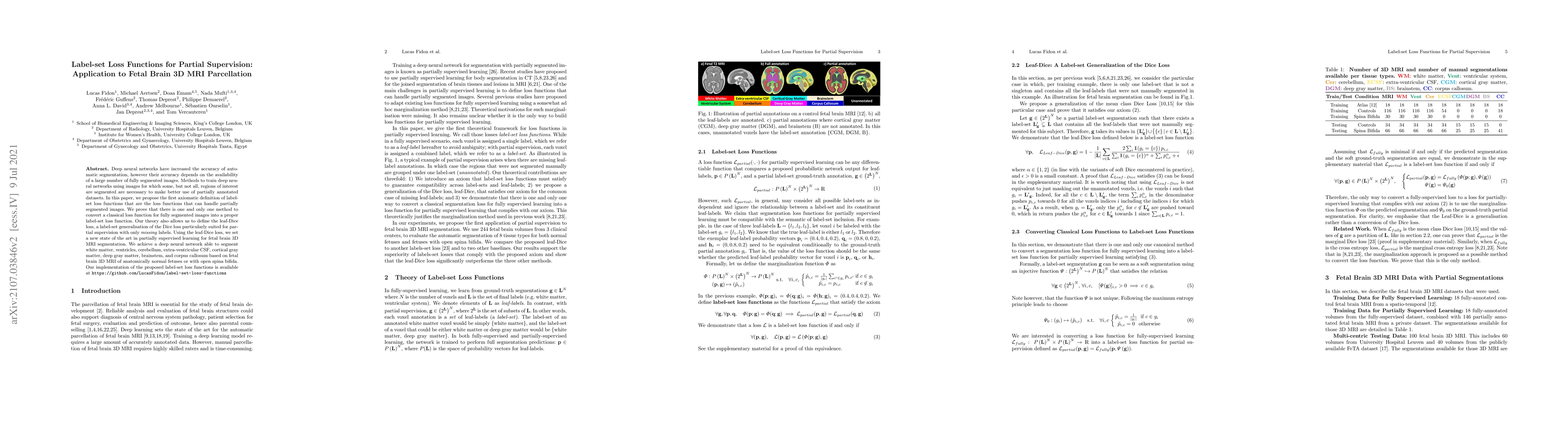Thumbnail for Label-set Loss Functions for Partial Supervision: Application to Fetal
  Brain 3D MRI Parcellation