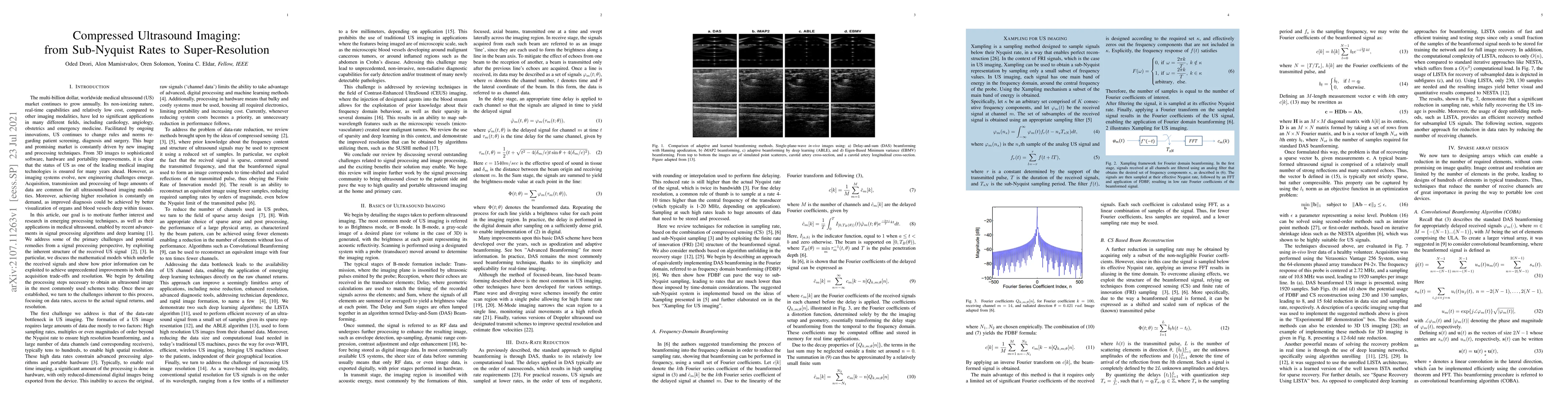 Thumbnail for Compressed Ultrasound Imaging:from Sub-Nyquist Rates to Super-Resolution