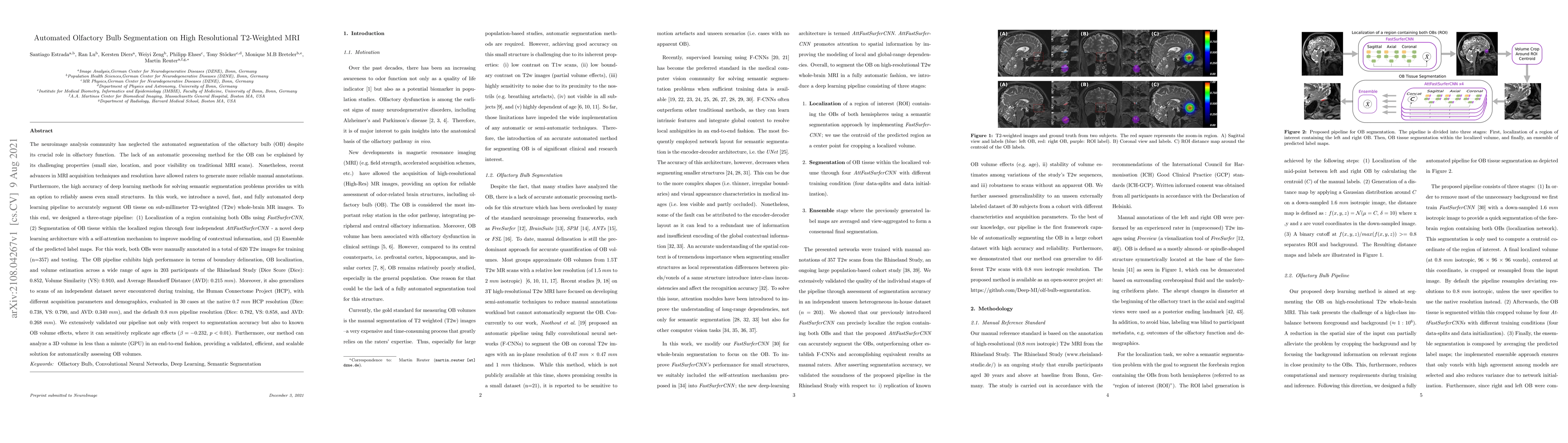 Thumbnail for Automated Olfactory Bulb Segmentation on High Resolutional T2-Weighted
  MRI