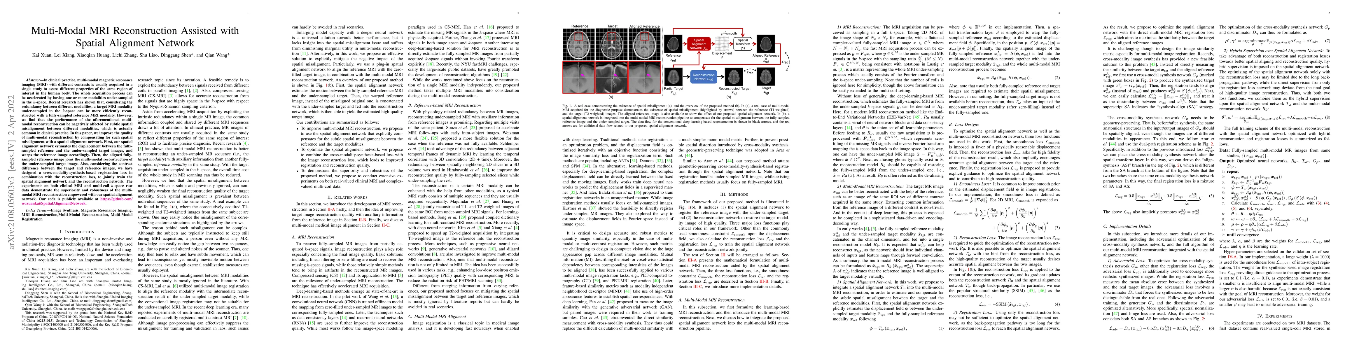 Thumbnail for Multi-Modal MRI Reconstruction Assisted with Spatial Alignment Network