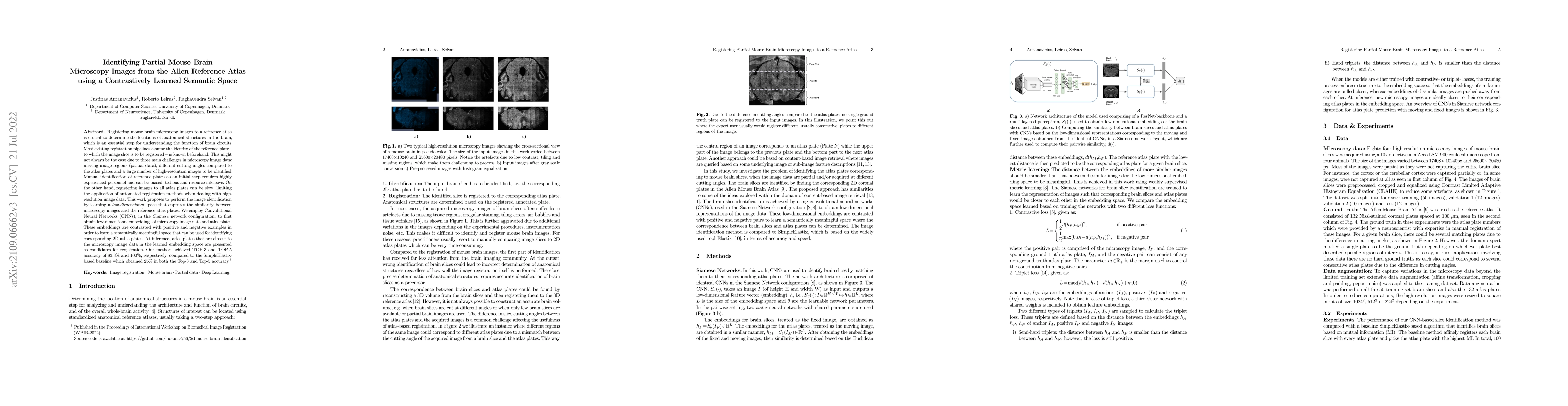 Thumbnail for Identifying partial mouse brain microscopy images from Allen reference
  atlas using a contrastively learned semantic space