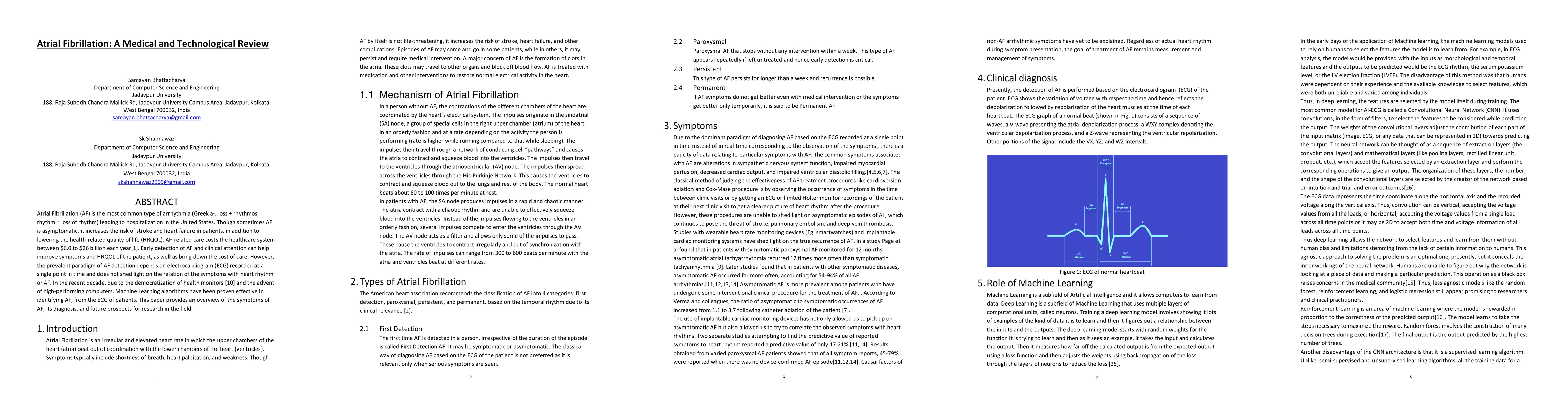 Thumbnail for Atrial Fibrillation: A Medical and Technological Review