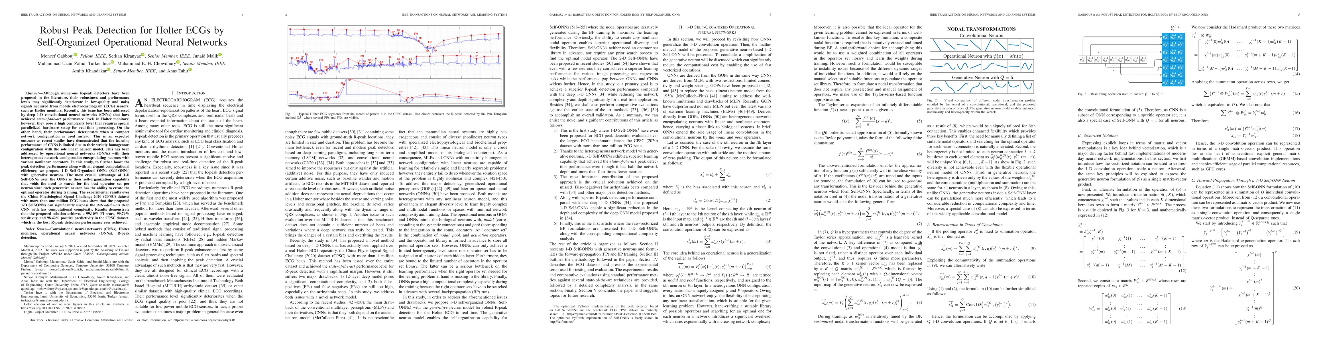 Thumbnail for Robust Peak Detection for Holter ECGs by Self-Organized Operational
  Neural Networks