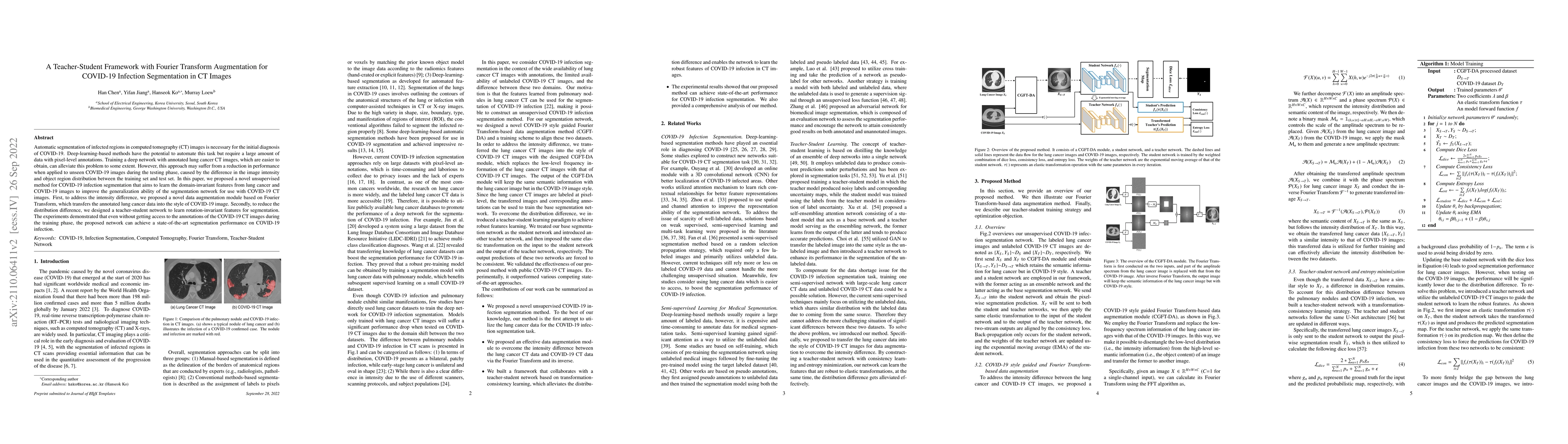 Thumbnail for A Teacher-Student Framework with Fourier Augmentation for COVID-19
  Infection Segmentation in CT Images