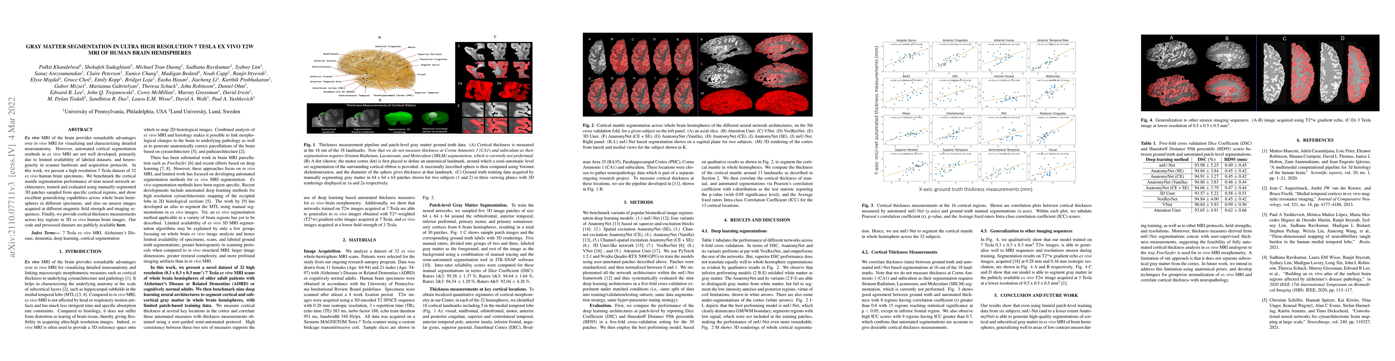 Thumbnail for Gray Matter Segmentation in Ultra High Resolution 7 Tesla ex vivo T2w
  MRI of Human Brain Hemispheres