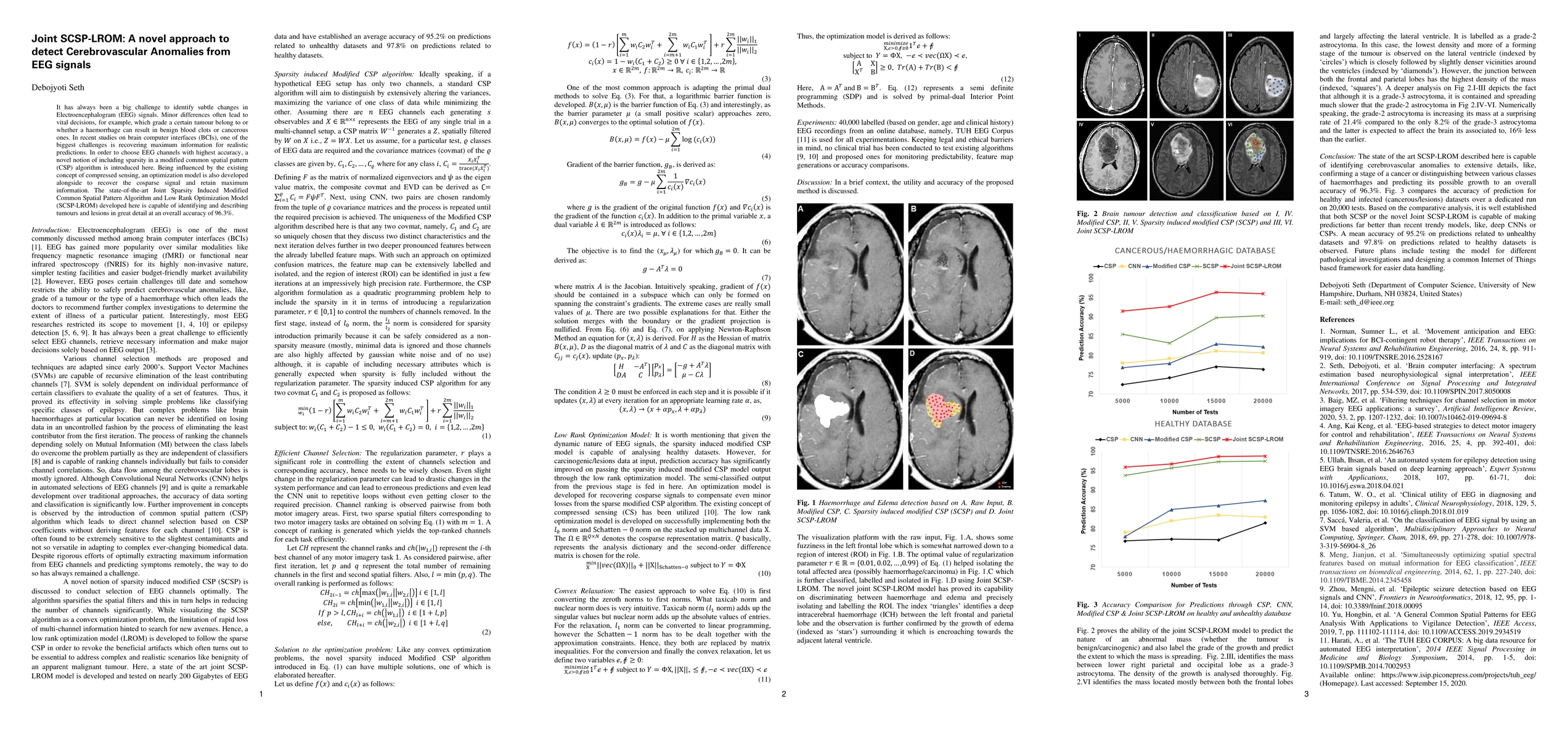 Thumbnail for Joint SCSP-LROM: A novel approach to detect Cerebrovascular Anomalies
  from EEG signals
