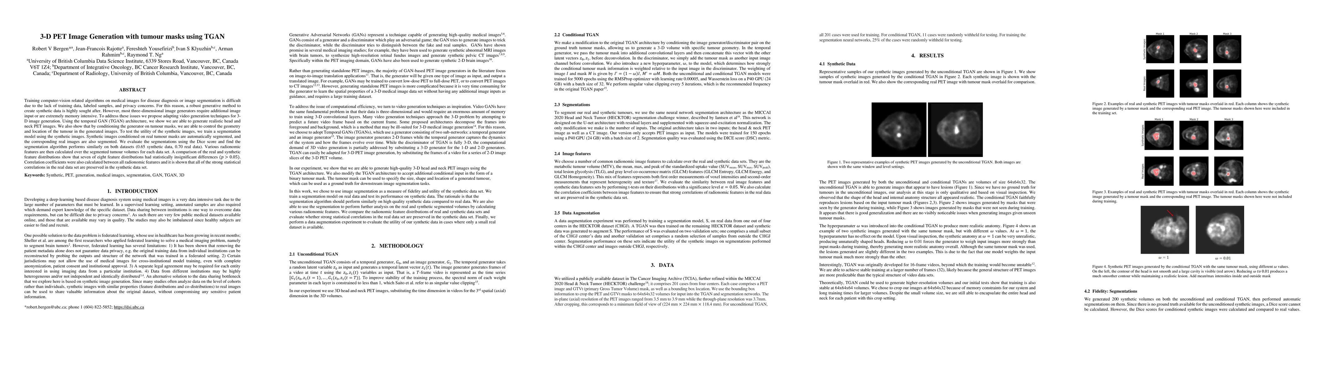 Thumbnail for 3-D PET Image Generation with tumour masks using TGAN