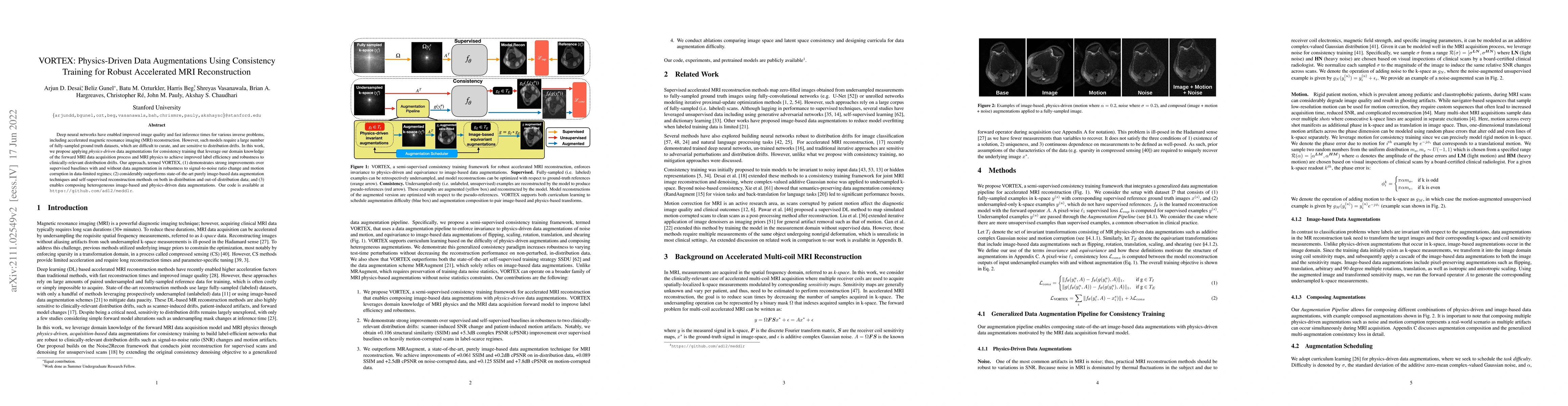 Thumbnail for VORTEX: Physics-Driven Data Augmentations Using Consistency Training for
  Robust Accelerated MRI Reconstruction