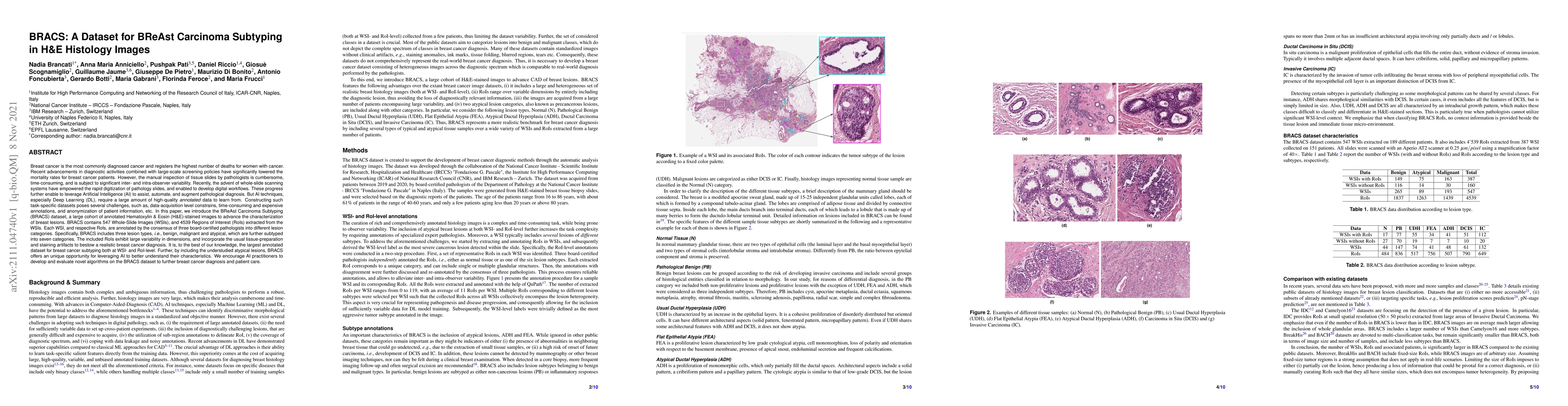 Thumbnail for BRACS: A Dataset for BReAst Carcinoma Subtyping in H&E Histology Images