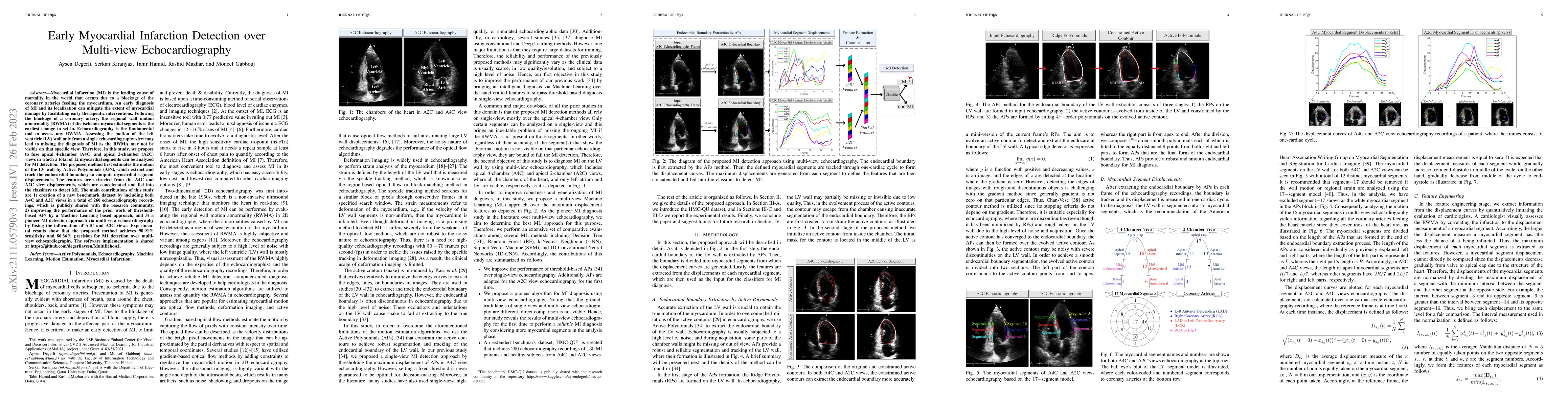 Thumbnail for Early Myocardial Infarction Detection over Multi-view Echocardiography