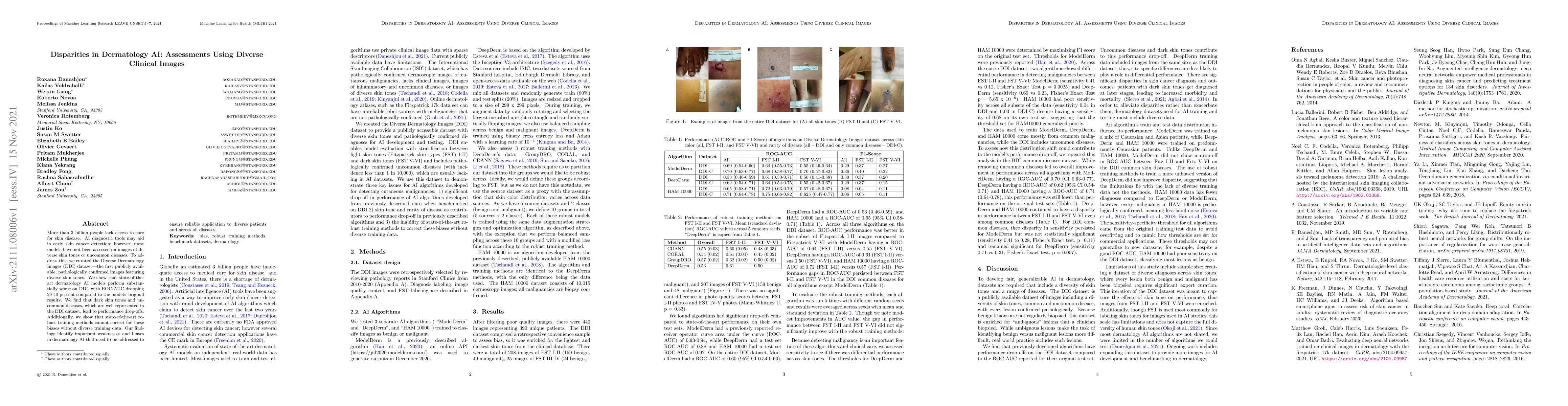 Thumbnail for Disparities in Dermatology AI: Assessments Using Diverse Clinical Images