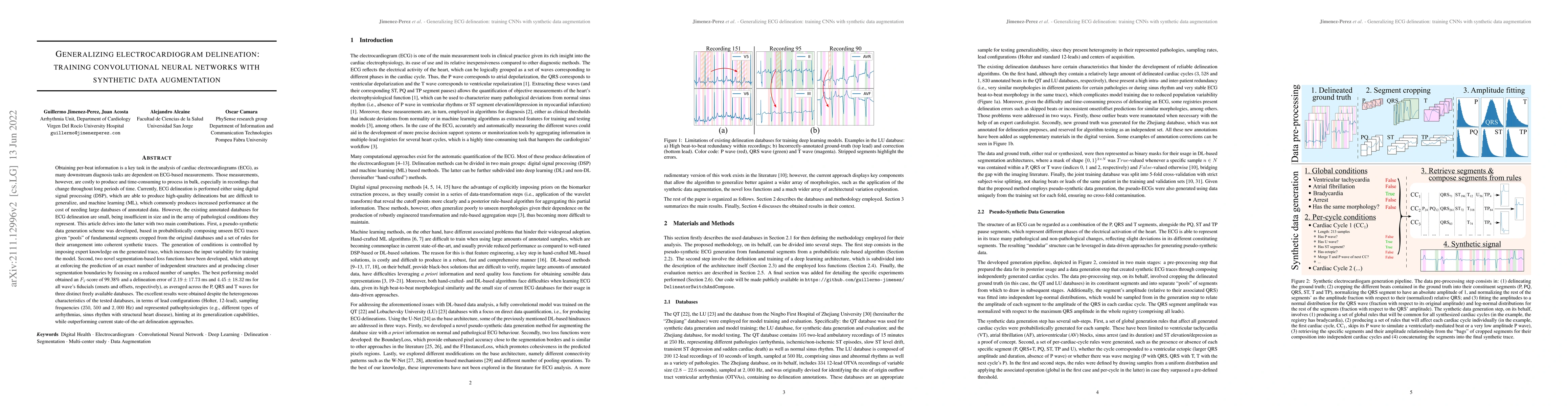 Thumbnail for Generalizing electrocardiogram delineation -- Training convolutional
  neural networks with synthetic data augmentation