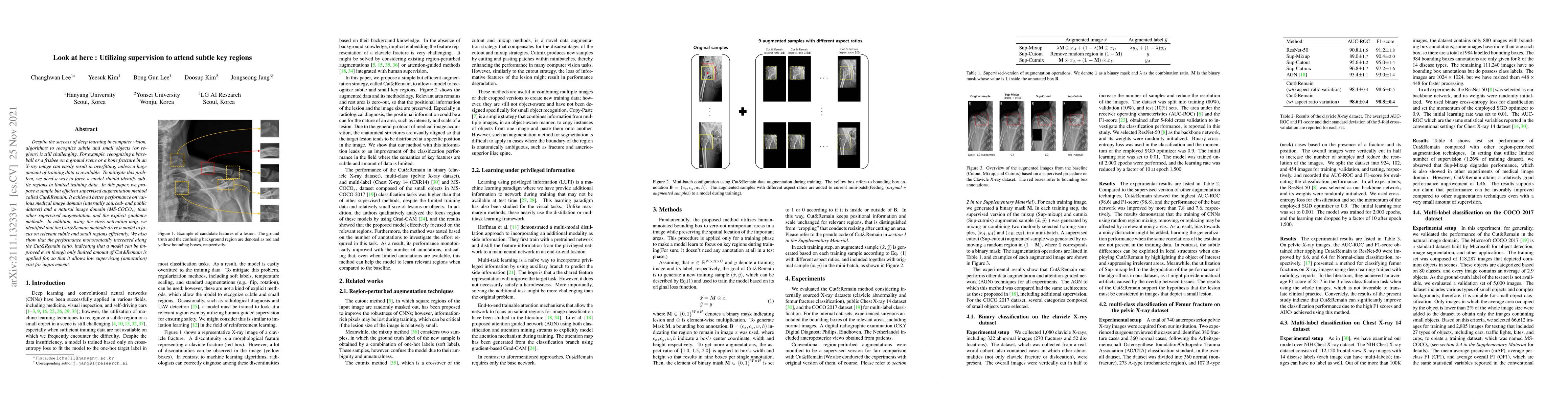 Thumbnail for Look at here : Utilizing supervision to attend subtle key regions