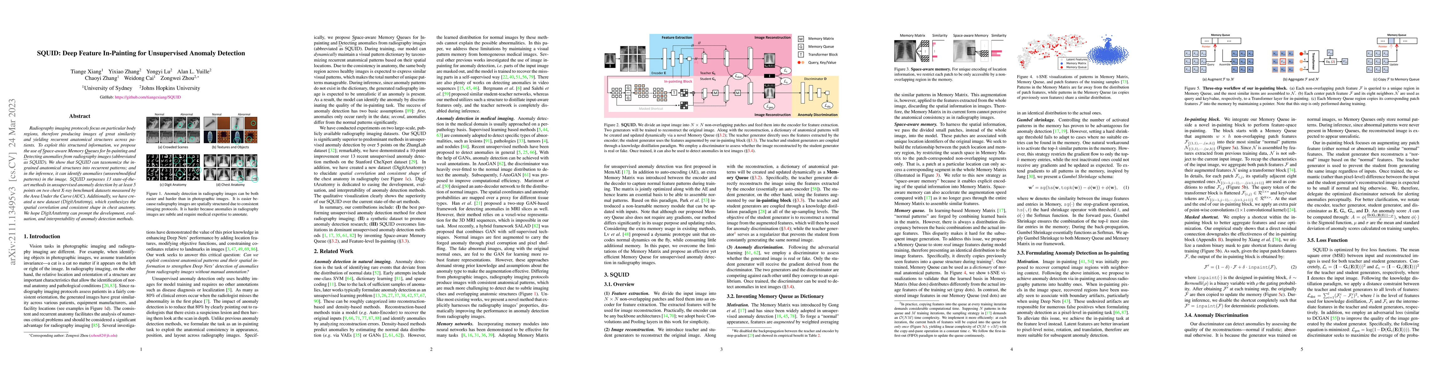 Thumbnail for SQUID: Deep Feature In-Painting for Unsupervised Anomaly Detection