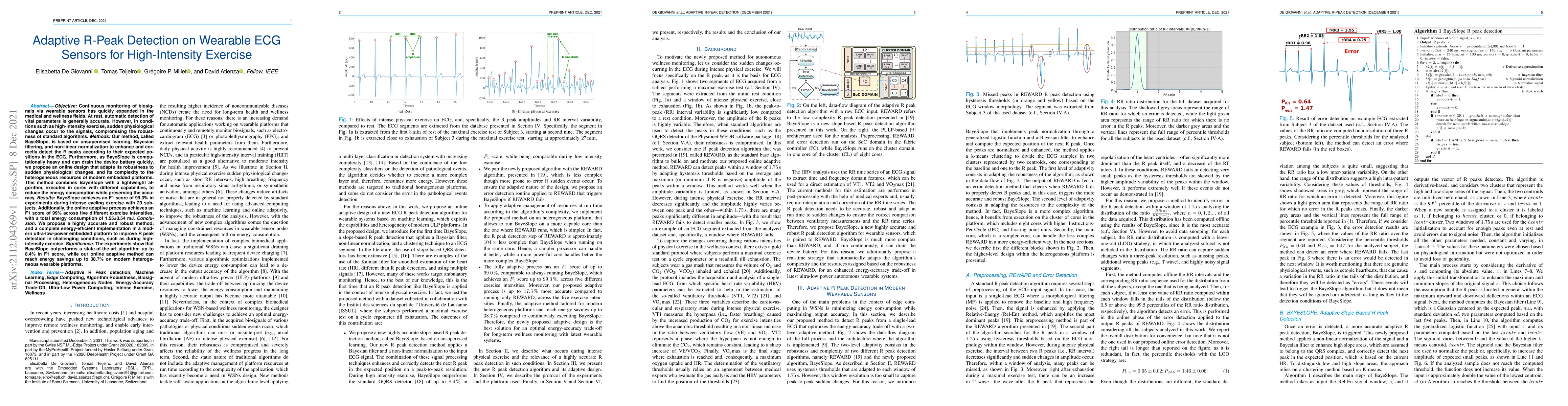 Thumbnail for Adaptive R-Peak Detection on Wearable ECG Sensors for High-Intensity
  Exercise