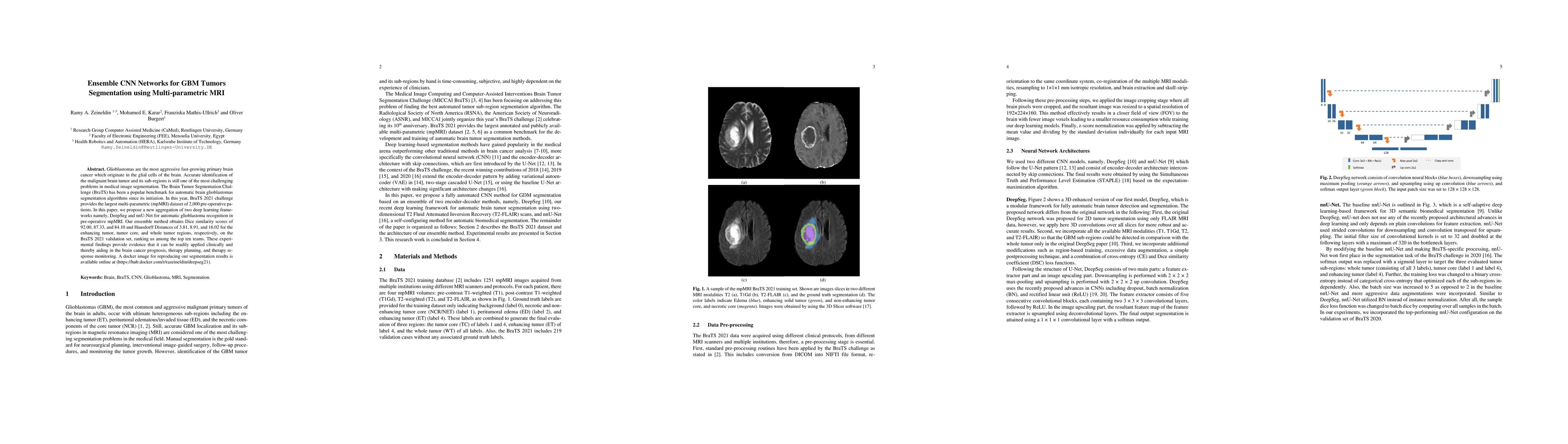 Thumbnail for Ensemble CNN Networks for GBM Tumors Segmentation using Multi-parametric
  MRI