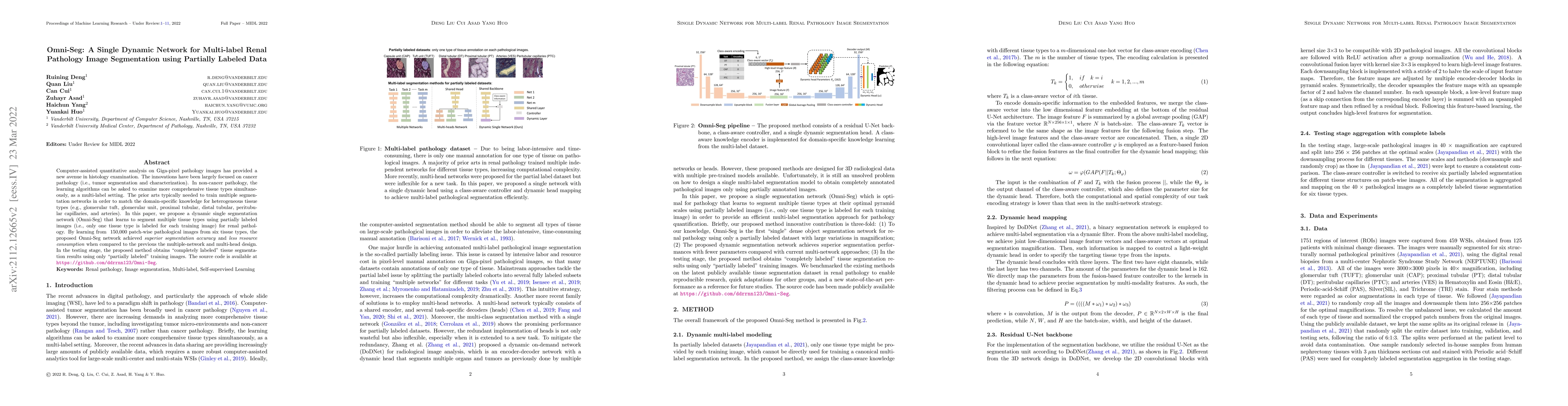 Thumbnail for Omni-Seg: A Single Dynamic Network for Multi-label Renal Pathology Image
  Segmentation using Partially Labeled Data