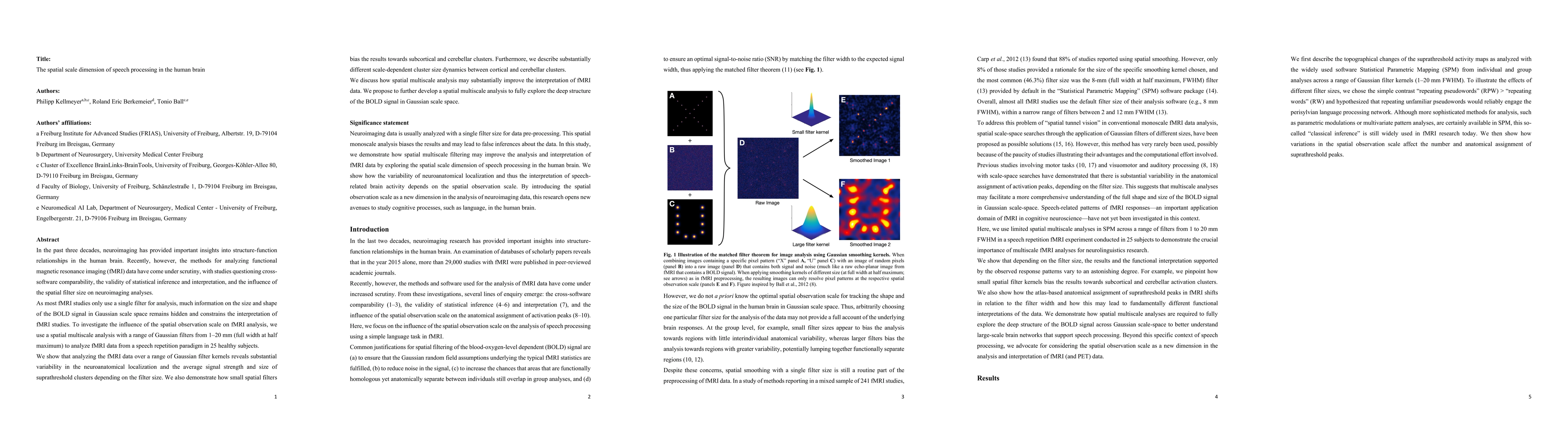 Thumbnail for The spatial scale dimension of speech processing in the human brain
