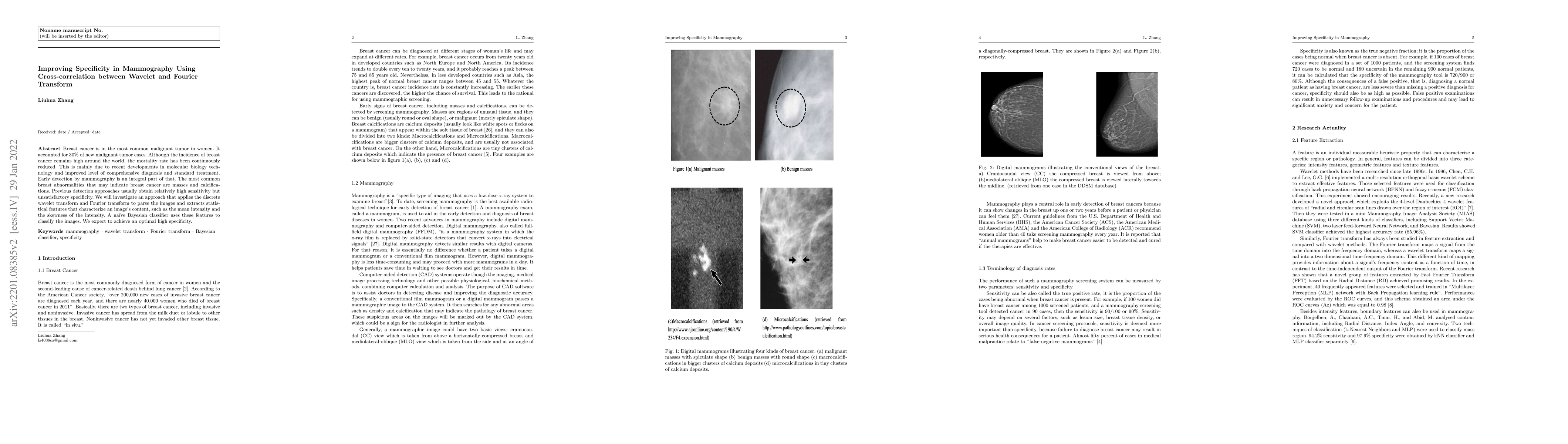 Thumbnail for Improving Specificity in Mammography Using Cross-correlation between
  Wavelet and Fourier Transform