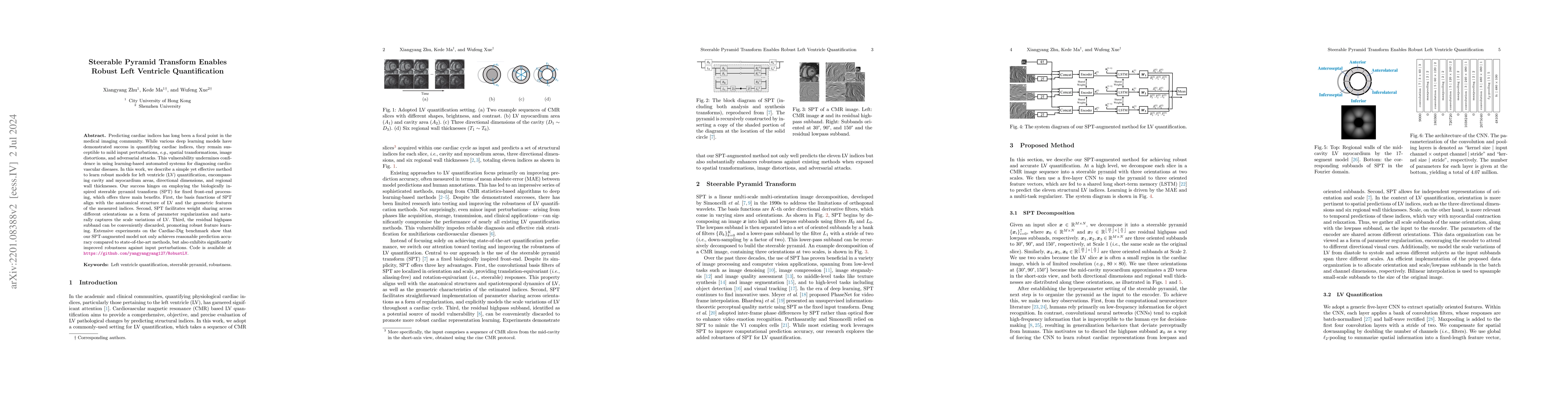Thumbnail for Steerable Pyramid Transform Enables Robust Left Ventricle Quantification