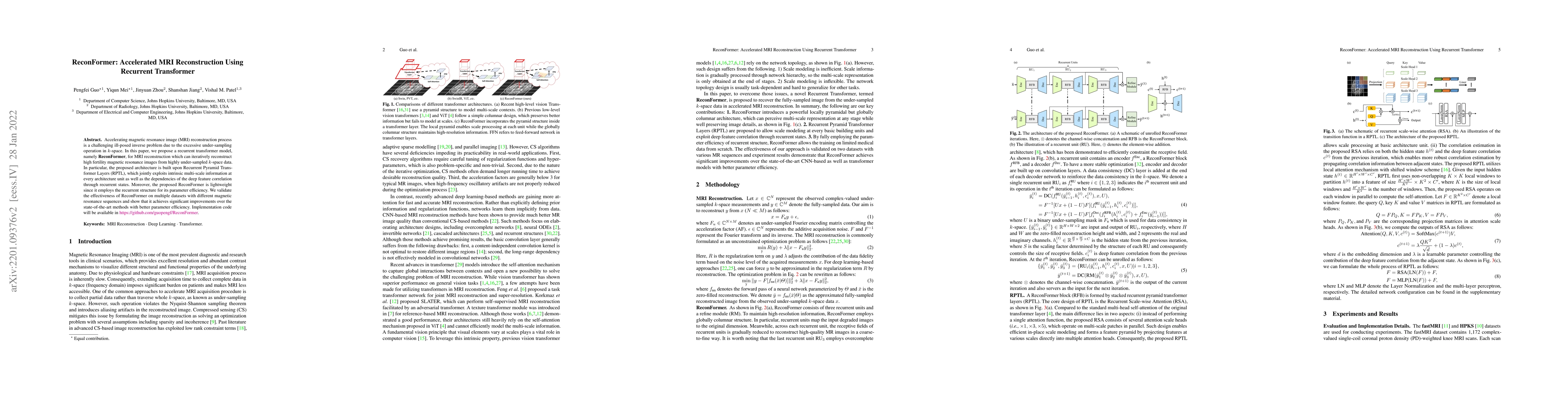 Thumbnail for ReconFormer: Accelerated MRI Reconstruction Using Recurrent Transformer