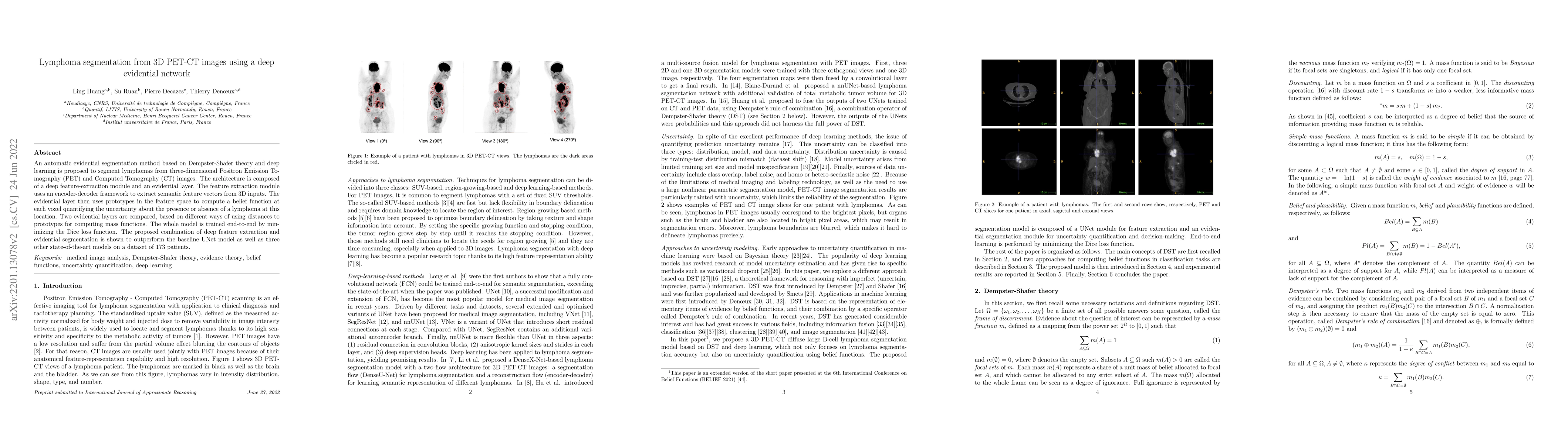 Thumbnail for Lymphoma segmentation from 3D PET-CT images using a deep evidential
  network