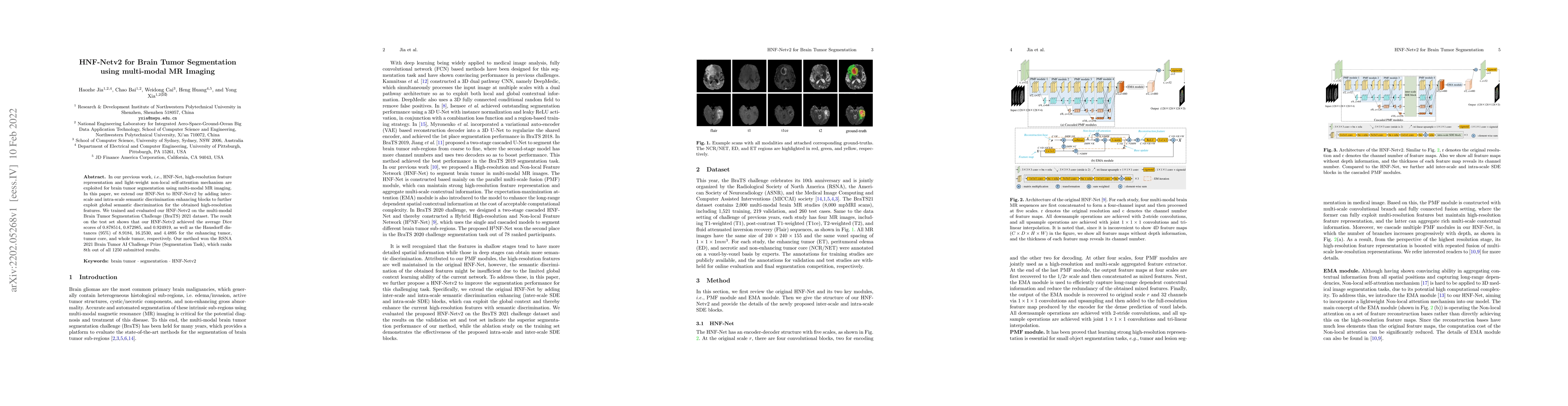 Thumbnail for HNF-Netv2 for Brain Tumor Segmentation using multi-modal MR Imaging