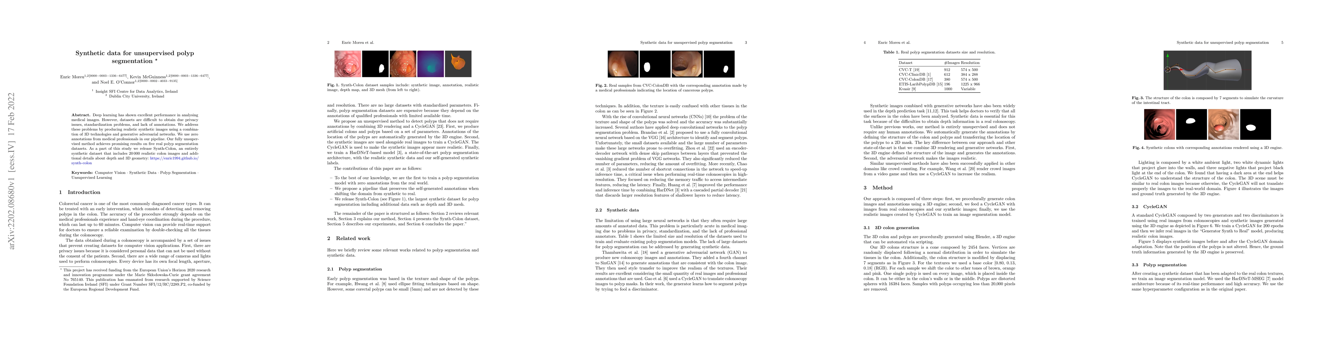 Thumbnail for Synthetic data for unsupervised polyp segmentation