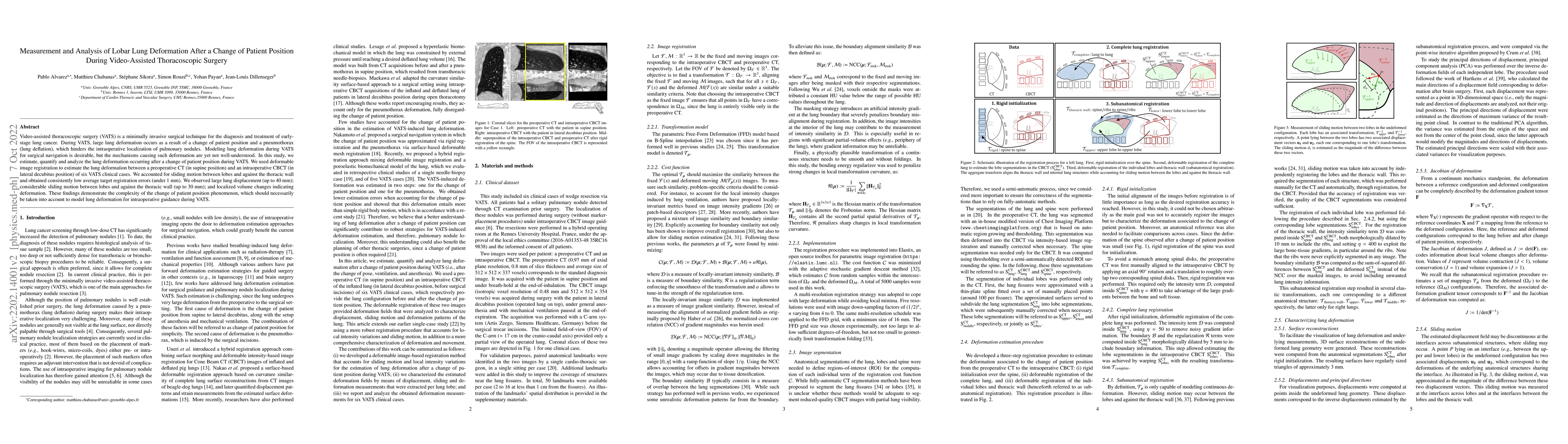 Thumbnail for Measurement and Analysis of Lobar Lung Deformation After a Change of
  Patient Position During Video-Assisted Thoracoscopic Surgery