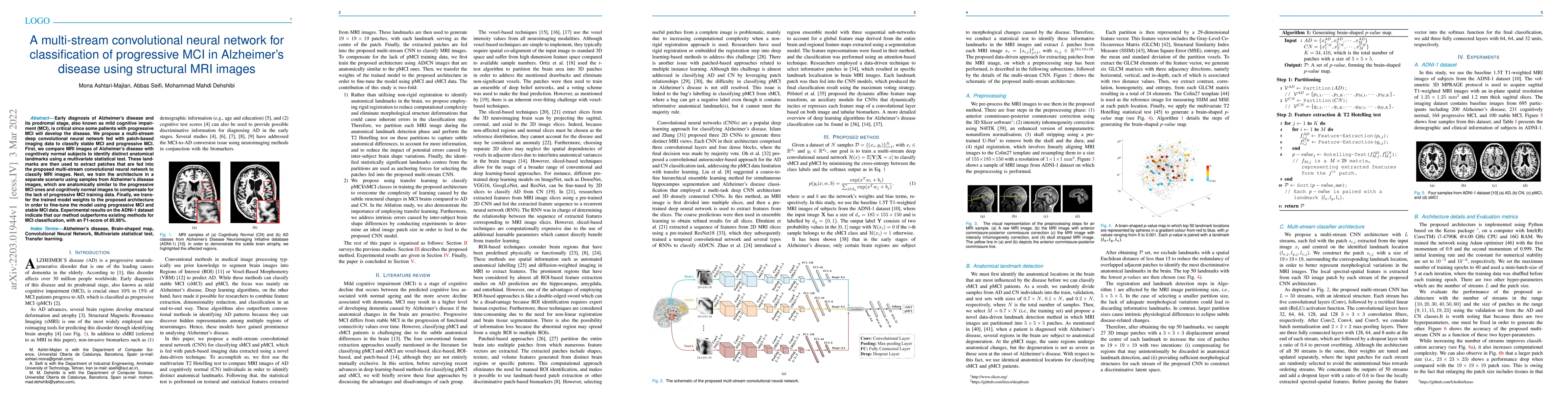 Thumbnail for A multi-stream convolutional neural network for classification of
  progressive MCI in Alzheimer's disease using structural MRI images