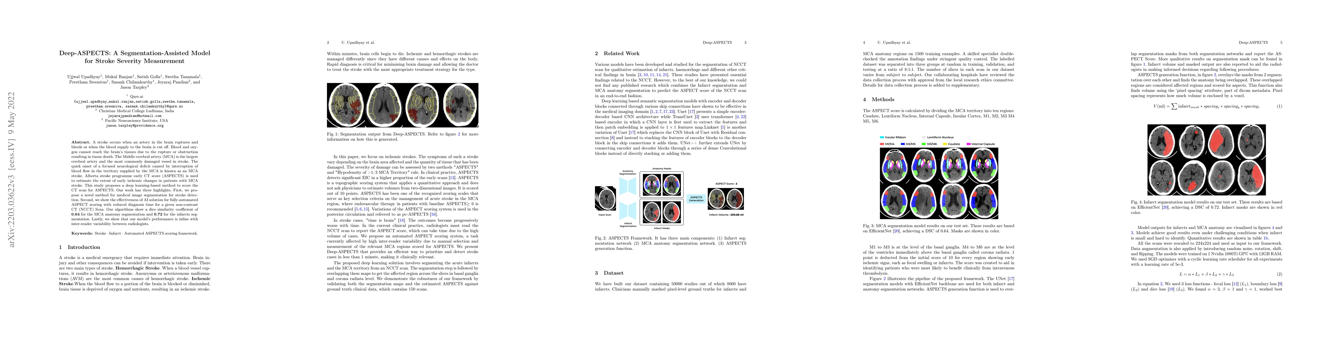 Thumbnail for Deep-ASPECTS: A Segmentation-Assisted Model for Stroke Severity
  Measurement