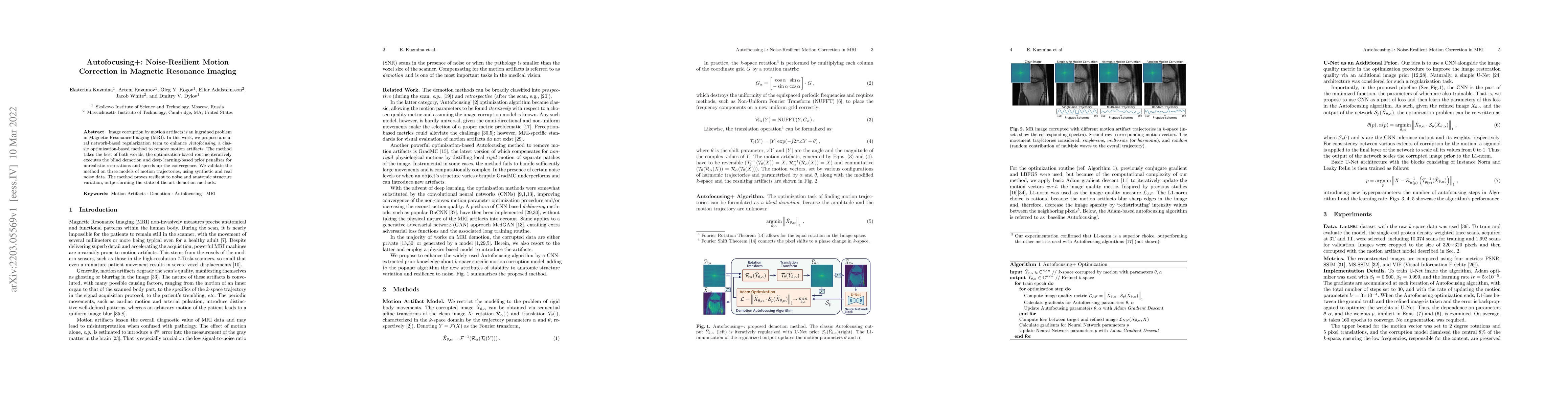 Thumbnail for Autofocusing+: Noise-Resilient Motion Correction in Magnetic Resonance
  Imaging