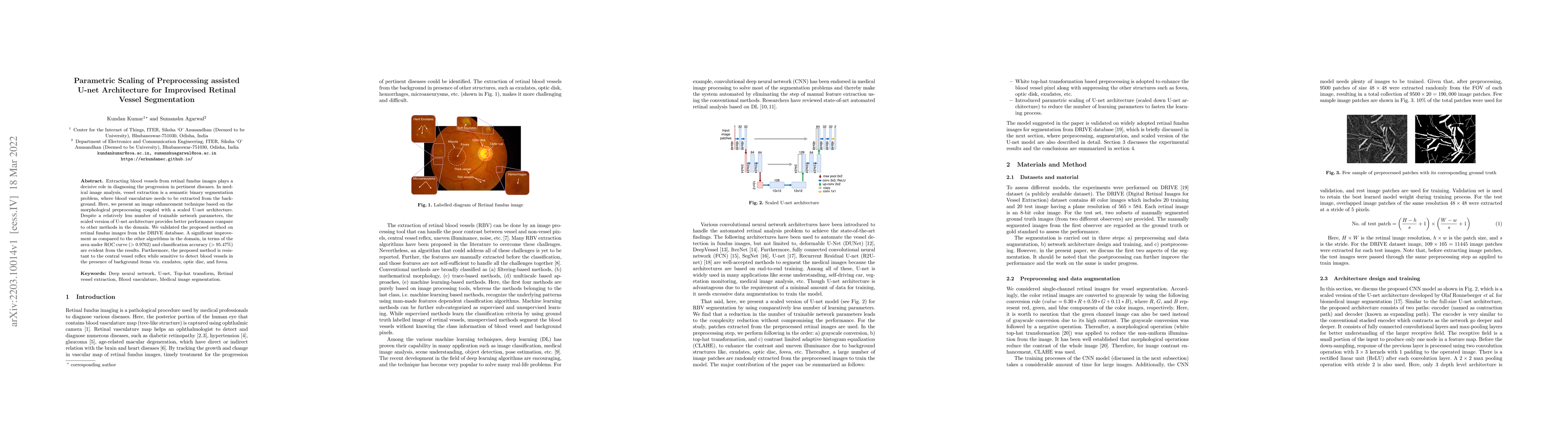 Thumbnail for Parametric Scaling of Preprocessing assisted U-net Architecture for
  Improvised Retinal Vessel Segmentation