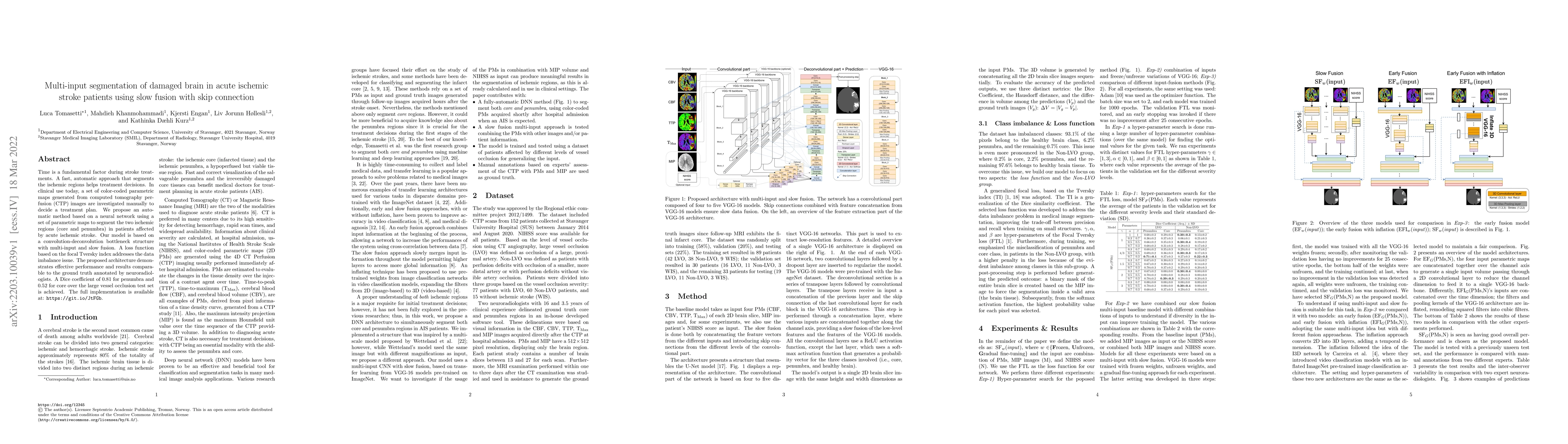 Thumbnail for Multi-input segmentation of damaged brain in acute ischemic stroke
  patients using slow fusion with skip connection
