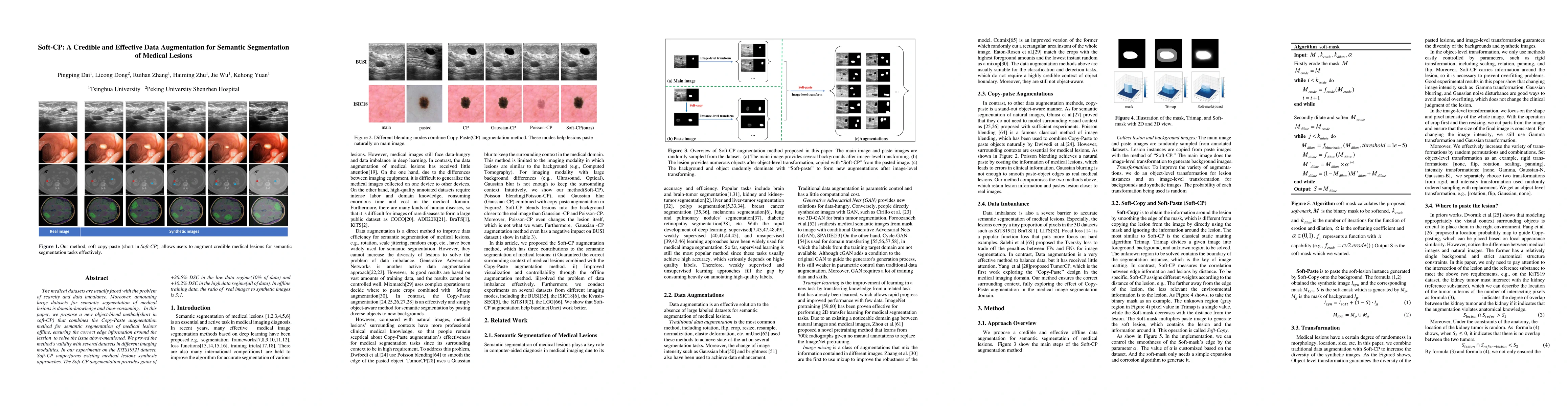 Thumbnail for Soft-CP: A Credible and Effective Data Augmentation for Semantic
  Segmentation of Medical Lesions
