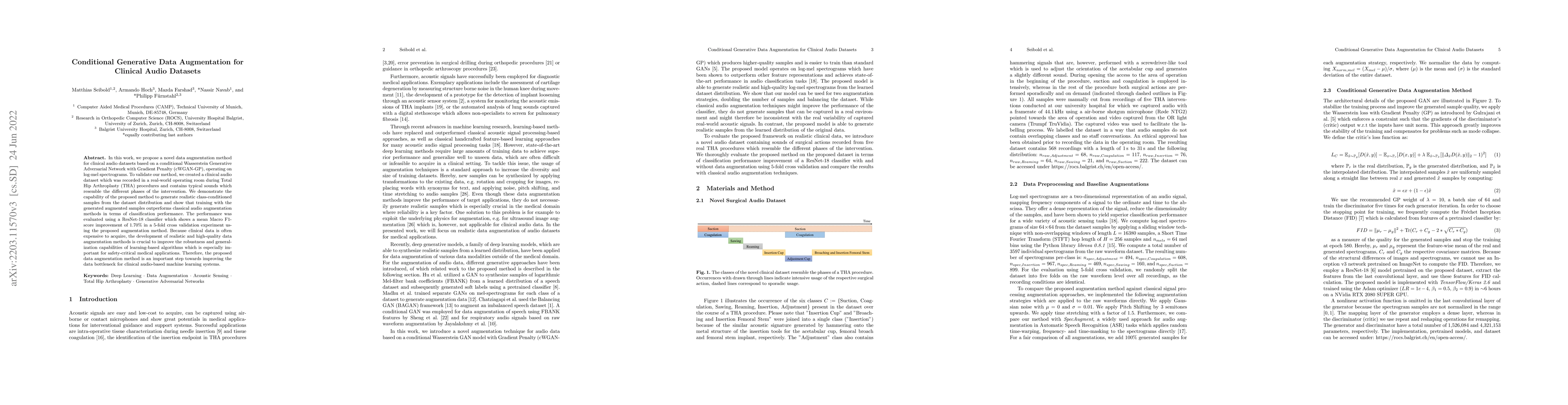 Thumbnail for Conditional Generative Data Augmentation for Clinical Audio Datasets