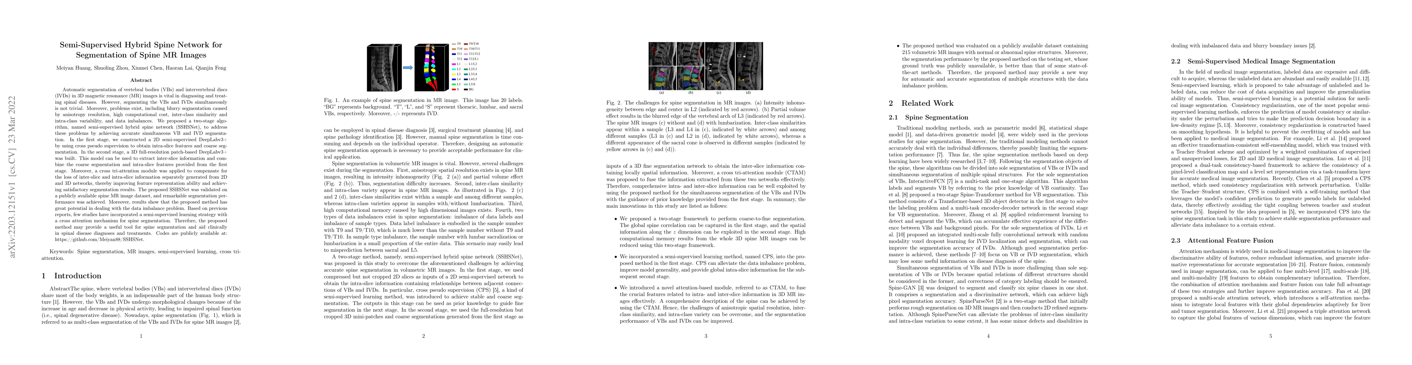 Thumbnail for Semi-Supervised Hybrid Spine Network for Segmentation of Spine MR Images