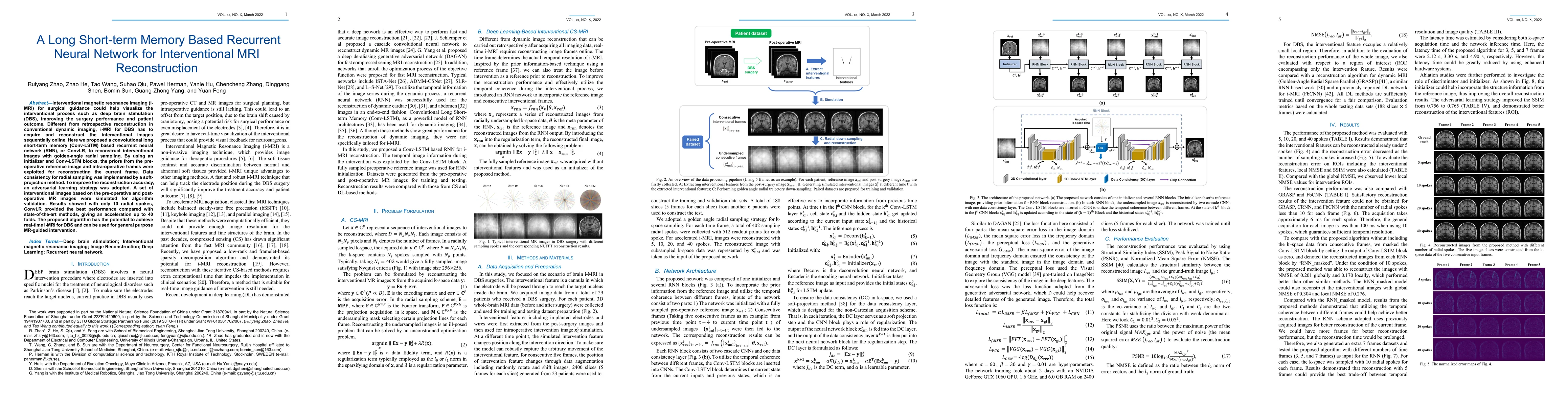 Thumbnail for A Long Short-term Memory Based Recurrent Neural Network for
  Interventional MRI Reconstruction