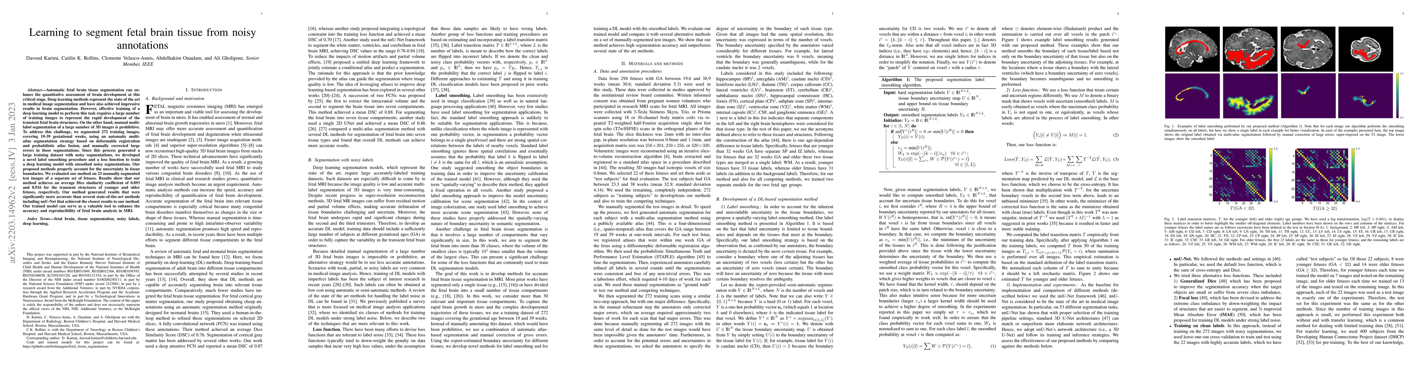 Thumbnail for Learning to segment fetal brain tissue from noisy annotations