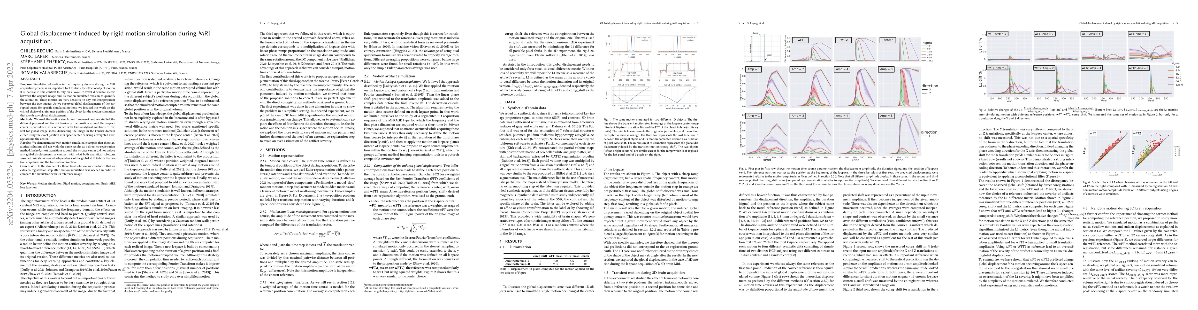 Thumbnail for Global displacement induced by rigid motion simulation during MRI
  acquisition