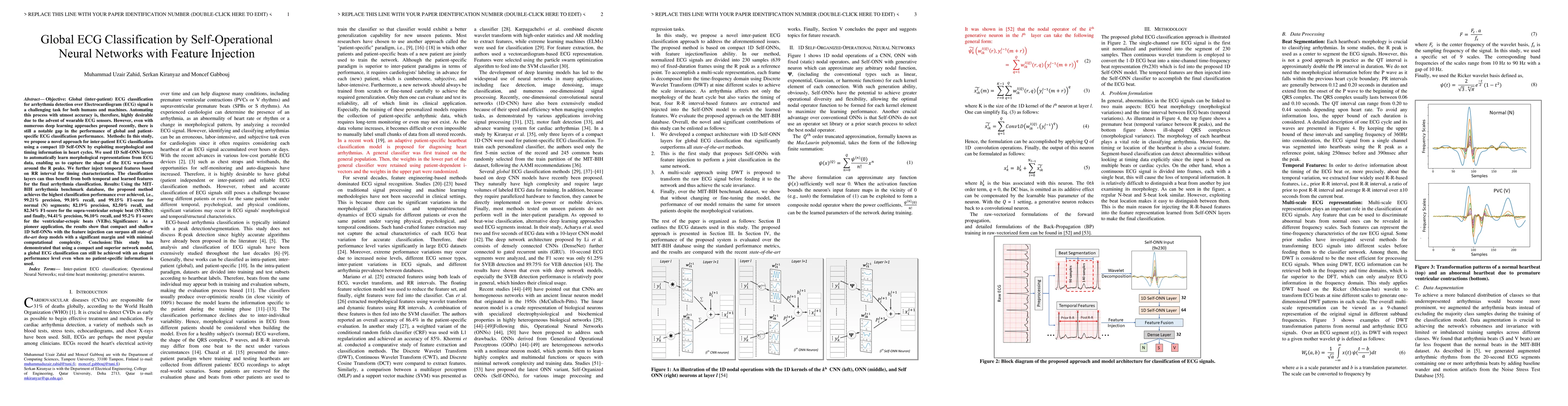 Thumbnail for Global ECG Classification by Self-Operational Neural Networks with
  Feature Injection