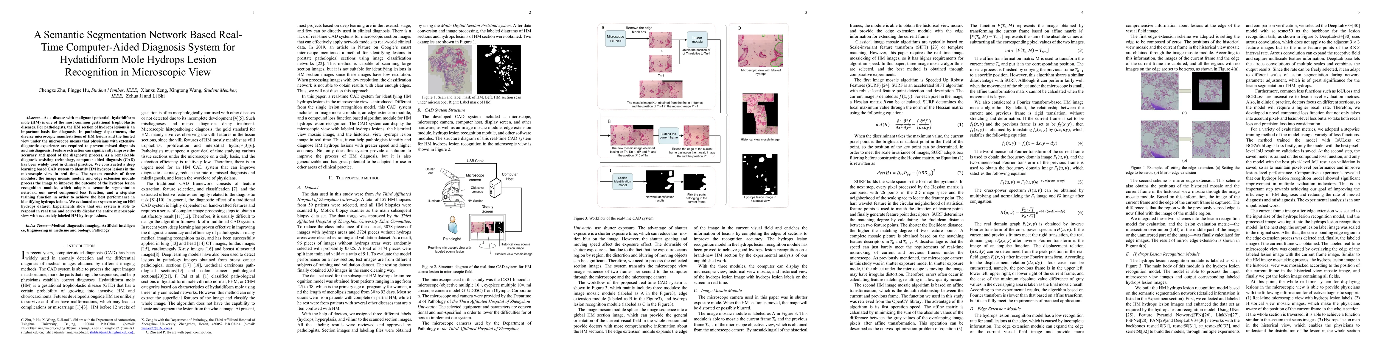 Thumbnail for A Semantic Segmentation Network Based Real-Time Computer-Aided Diagnosis
  System for Hydatidiform Mole Hydrops Lesion Recognition in Microscopic View