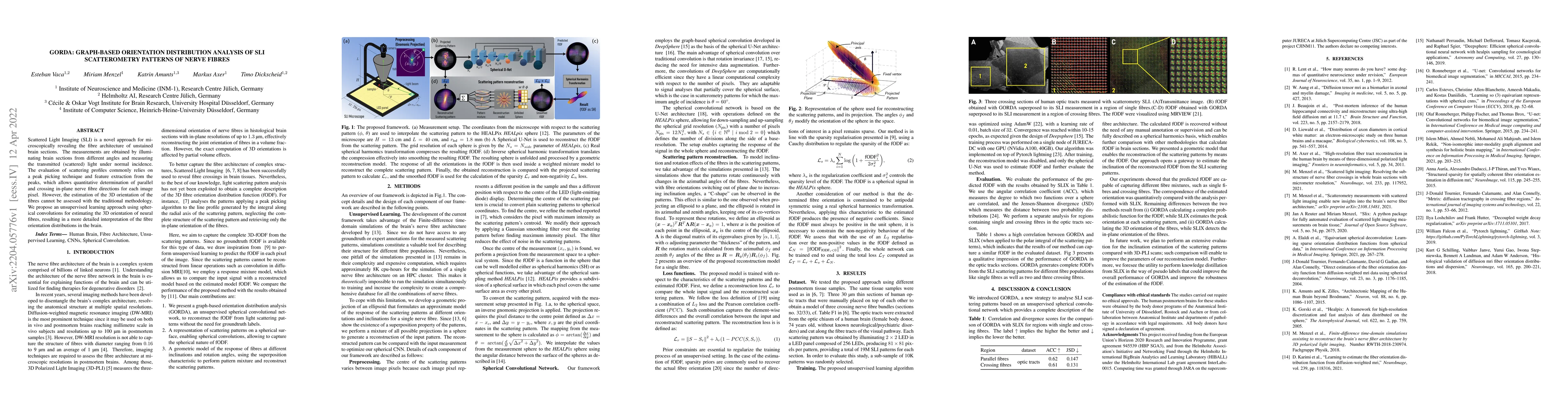 Thumbnail for GORDA: Graph-based ORientation Distribution Analysis of SLI
  scatterometry Patterns of Nerve Fibres