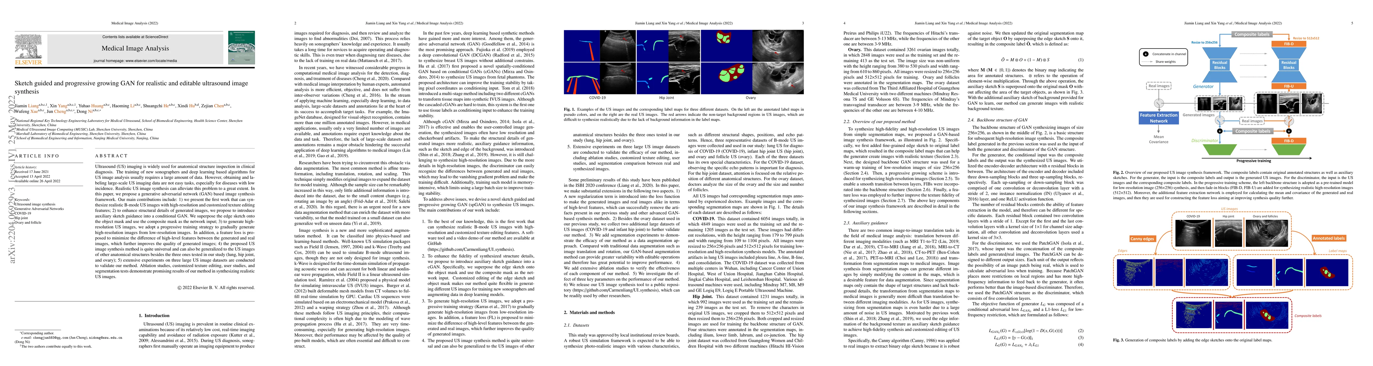 Thumbnail for Sketch guided and progressive growing GAN for realistic and editable
  ultrasound image synthesis