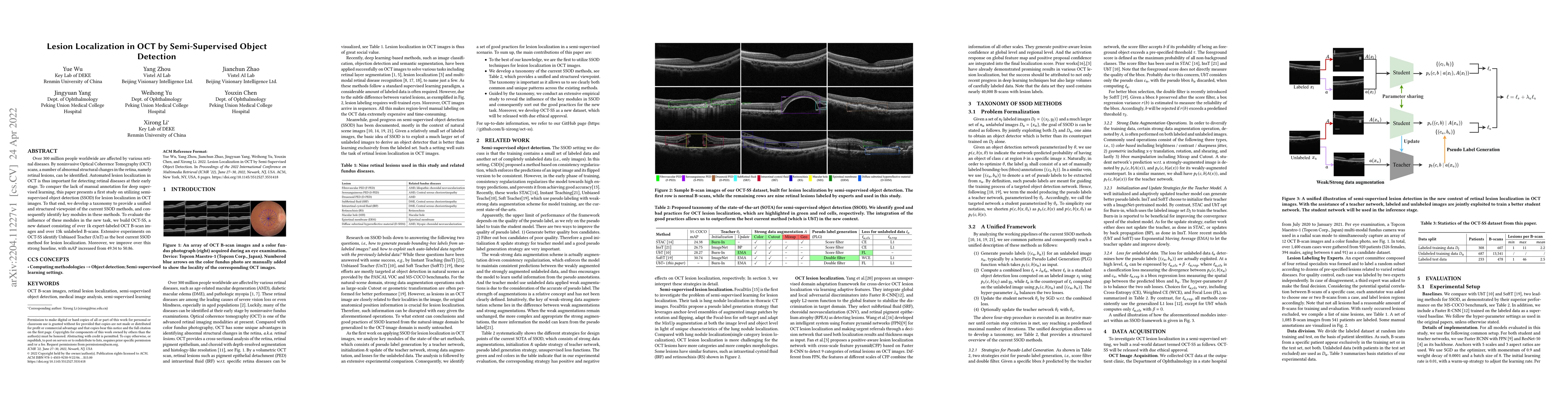 Thumbnail for Lesion Localization in OCT by Semi-Supervised Object Detection